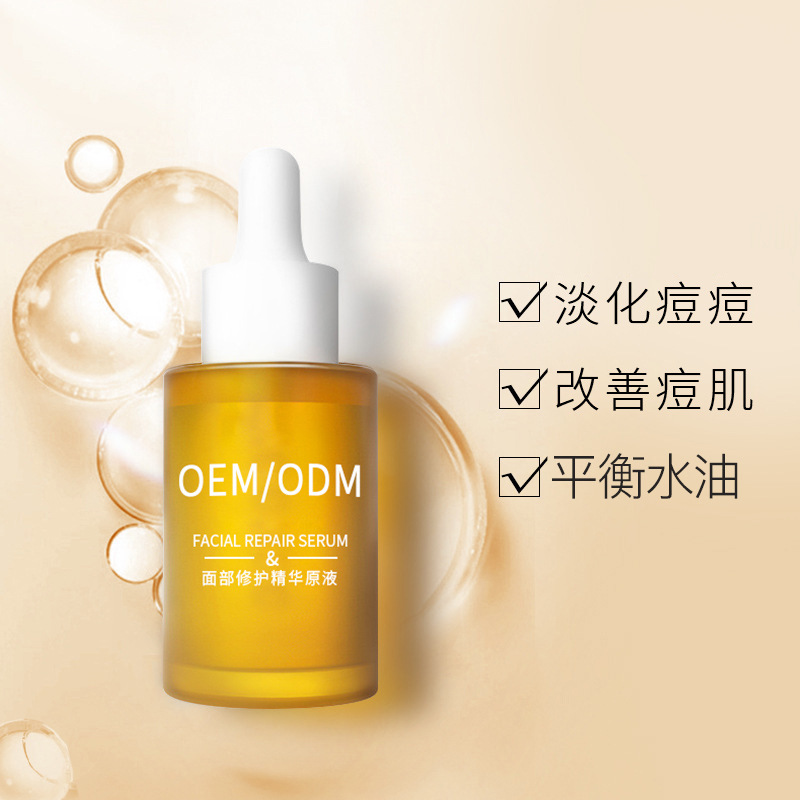 安科丽_祛痘精华原液OEM